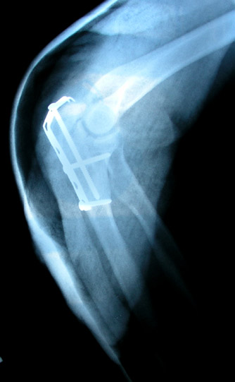 x ray hand. Lab 11: Organization of the